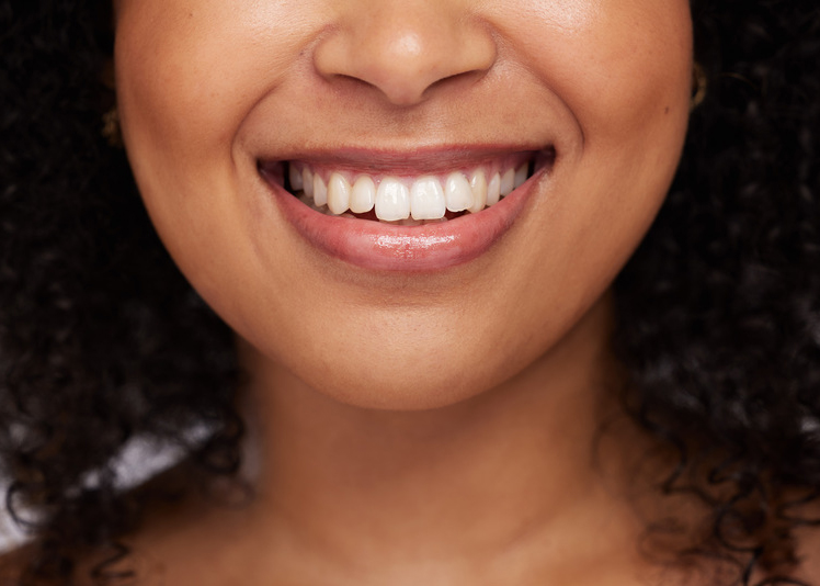 Black woman, teeth and smile for dental care, whitening or oral