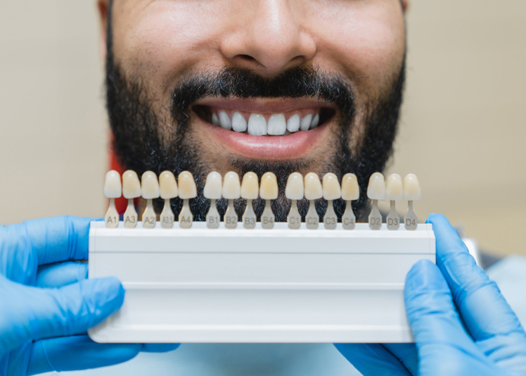 Dental care, implants for veneers. Man with perfect smile choosing teeth tooth tone at dental clinic